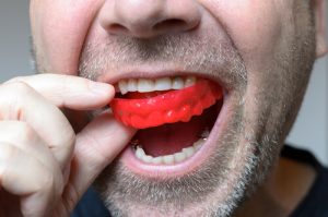 mouthguard to prevent cracked tooth