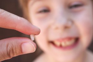 chipped tooth