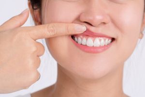 signs of gum disease first symptoms