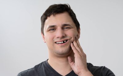 Molar Broke Off at Gum Line: What Are Your Options?
